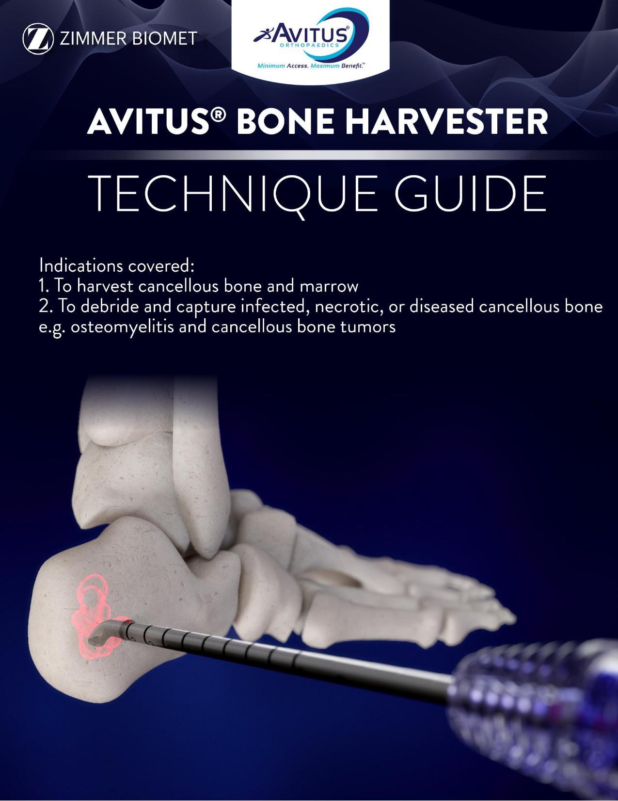 avitus-bone-harvester-surgical-technique-guide.pdf