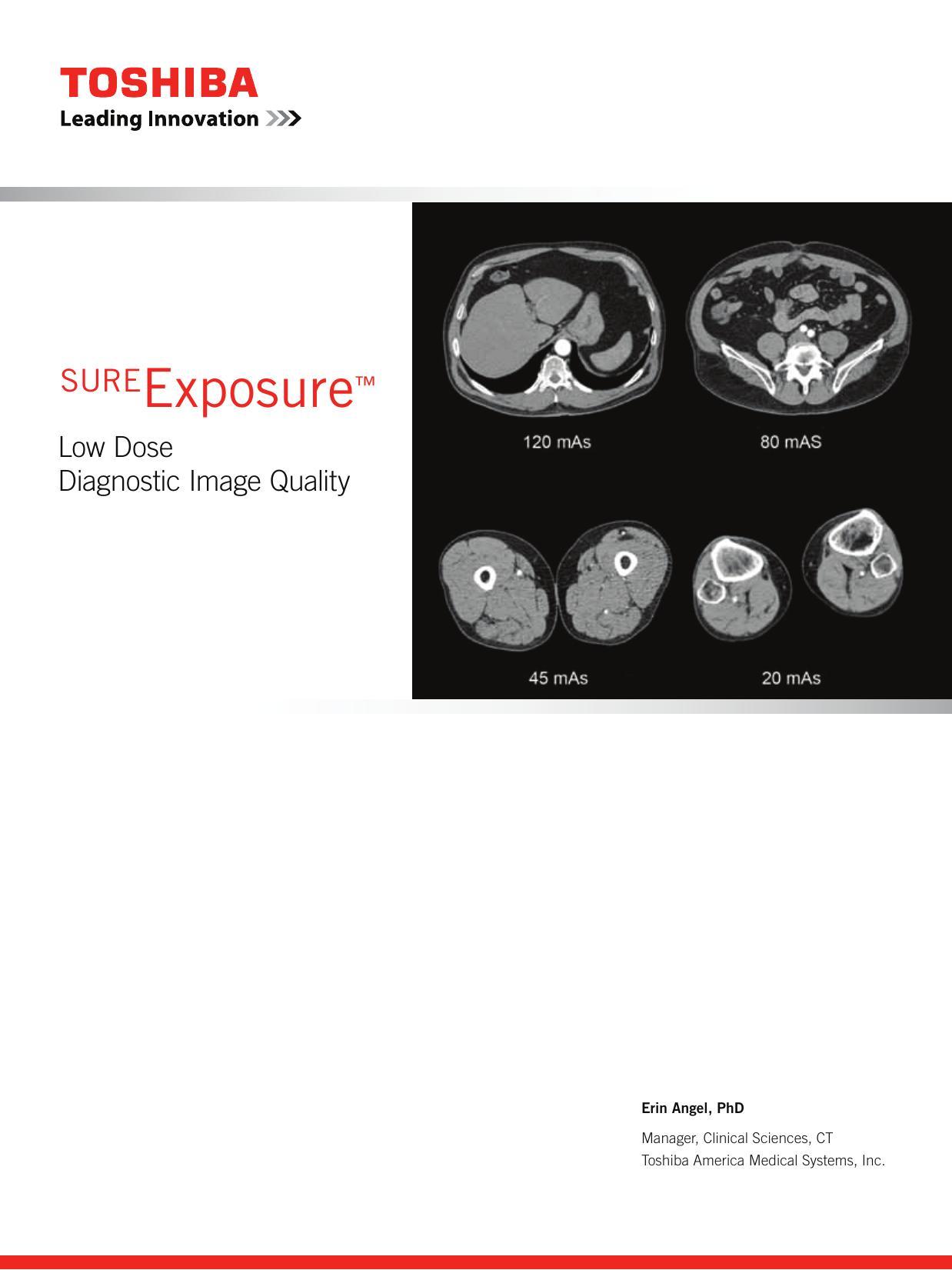 sureexposure-low-dose-diagnostic-image-quality.pdf