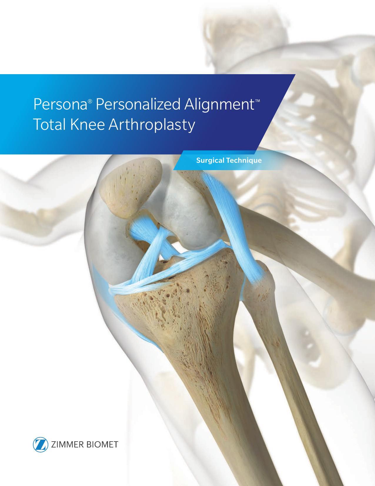 persona-personalized-alignment-total-knee-arthroplasty-surgical-technique.pdf