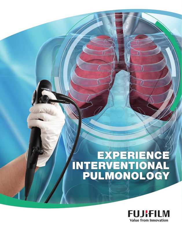 fujifilm-interventional-pulmonology-total-solution-system-530-580-scopes-processors-synapse-3d-bronchoscopy-product-line-up-su-1-ebus-sonosite-mini-probe.pdf