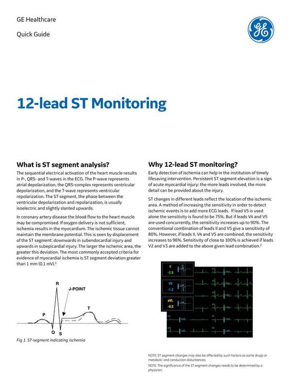 quick-guide-12-lead-st-monitoring.pdf